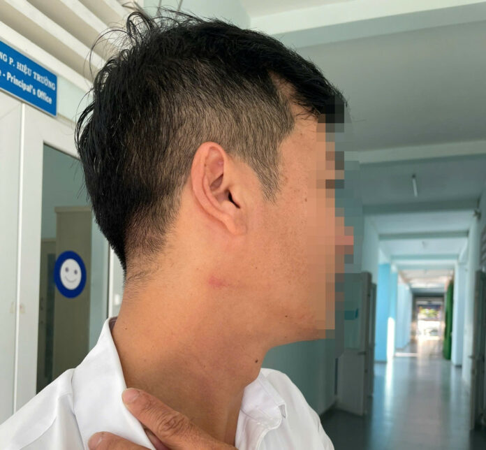 Sốc: Thầy Giáo Bị Đồng Nghiệp Bóp Cổ Ngay Giữa Sân Trường!