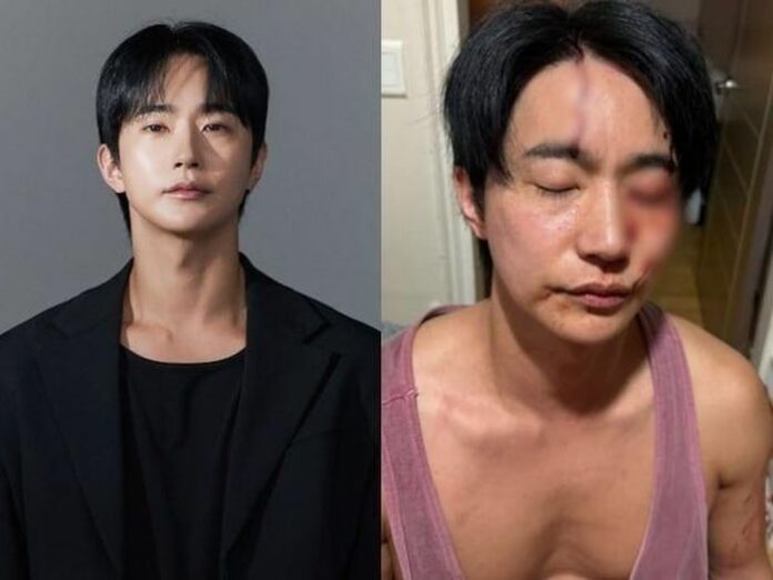 Jeon Ho Jun Được Minh Oan Sau Cáo Buộc Bạo Hành: Sự Thật Đằng Sau Scandal