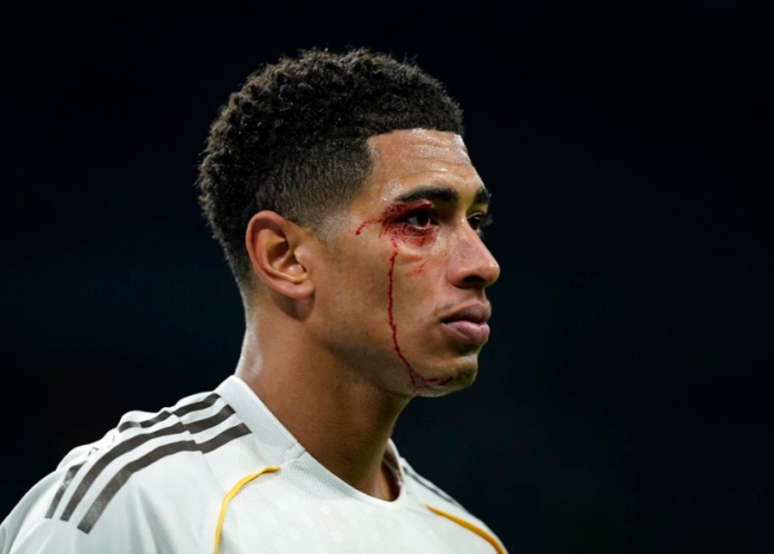 Real Madrid Trải Qua Đêm Ác Mộng: Thua 0-2, 9 Người Trên Sân, Bellingham Đổ Máu