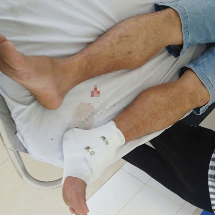 Vụ Cá Sấu Cắn Thầy Giáo Ở Tây Ninh: Bài Học Về Quản Lý Động Vật Hoang Dã