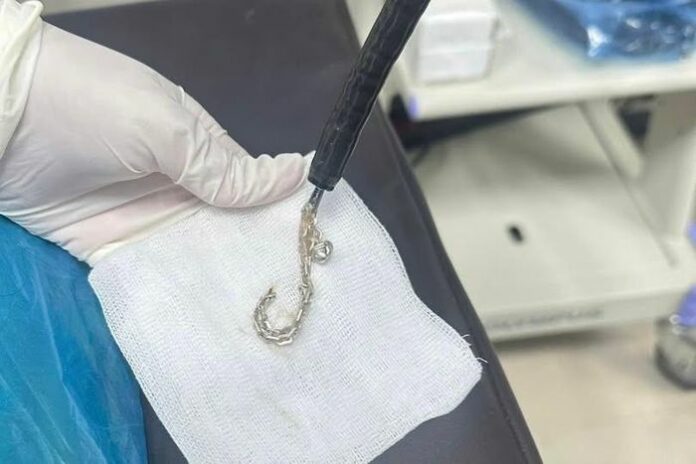 Cảnh giác! Bé 2 Tuổi Nuốt Lắc Bạc - Bài Học Nhớ Đời Cho Các Mẹ