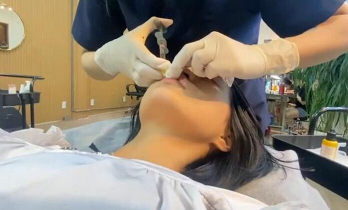 Cảnh báo: Nguy cơ biến chứng từ tiêm filler tại cơ sở 