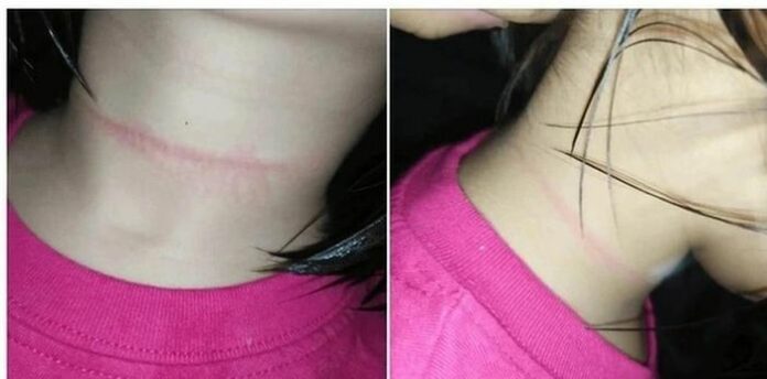 Cẩn trọng trước trào lưu 