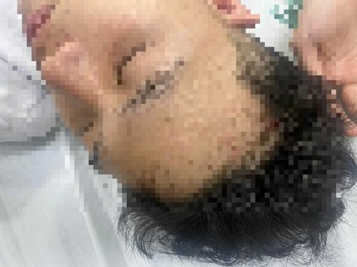 Truy tìm hung thủ chặn đánh nam sinh: Lời cảnh tỉnh về bạo lực đường phố