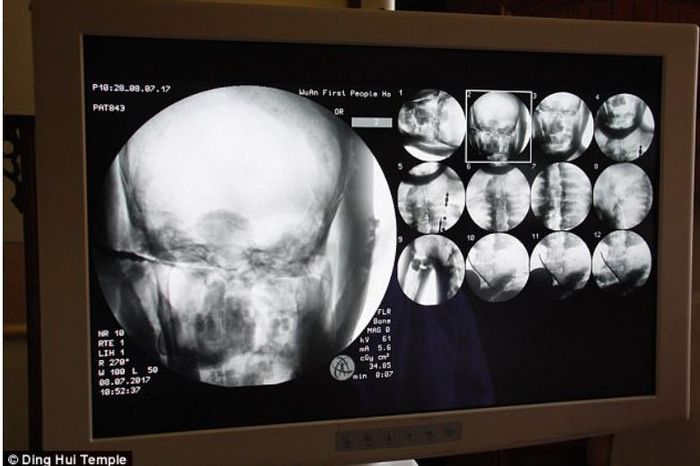 Những hình ảnh có được sau khi chụp CT. Daily Mail.